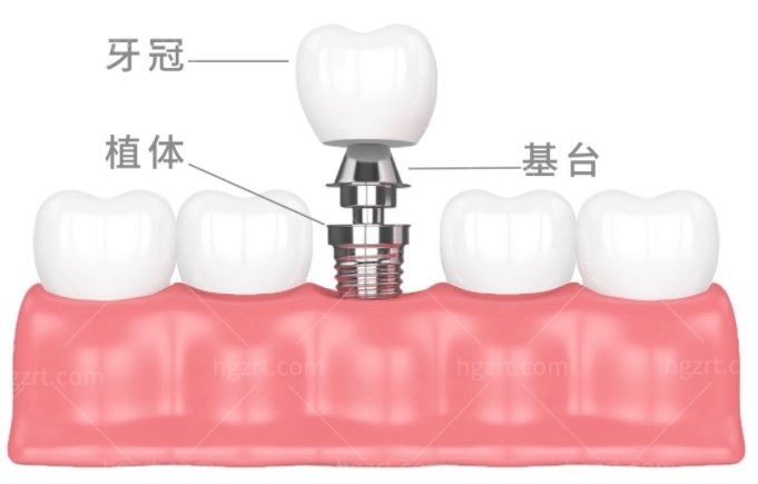 重庆美奥口腔6月活动