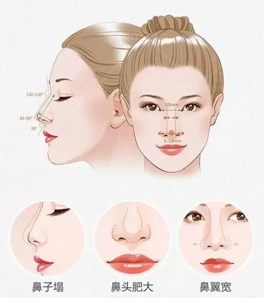 压箱底的医院！郑州集美美容医院鼻综合不到5000，简直不要太划算！