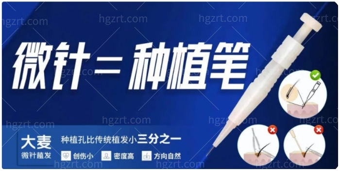 大麦微针植发技术
