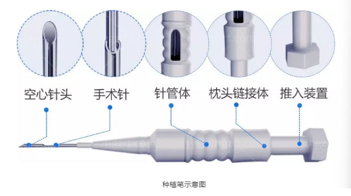 植发微针示意
