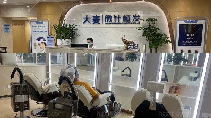 广州大麦微针植发分院
