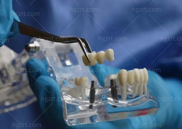 海曙口腔医院3500就可以种植牙，解决缺牙问题，不在望而却步，来看看**种植牙是不是可以报销