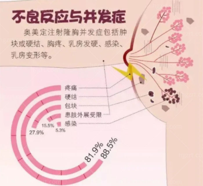 奥美定隆胸后遗症