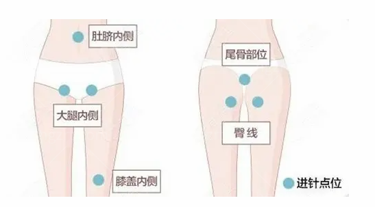 武汉艾美整形医院鼻综合不到13000,妈妈都不信! 武汉艾美整形医院鼻综合不到13000,妈妈都不信!
