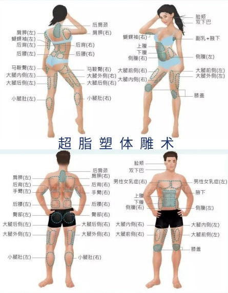 超脂塑体雕术与传统抽脂区别是什么