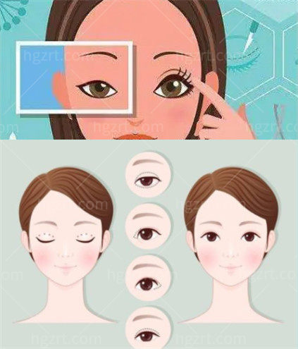 2022北京做眼综合整形的医院排行前十名单 盘点人气高眼科