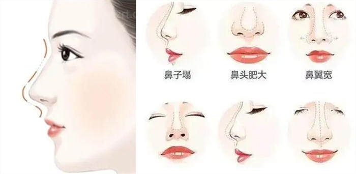 上海浦东有没有口碑技术好的整形医院 附优势项目