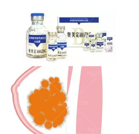 国内哪个医院可以取生长因子