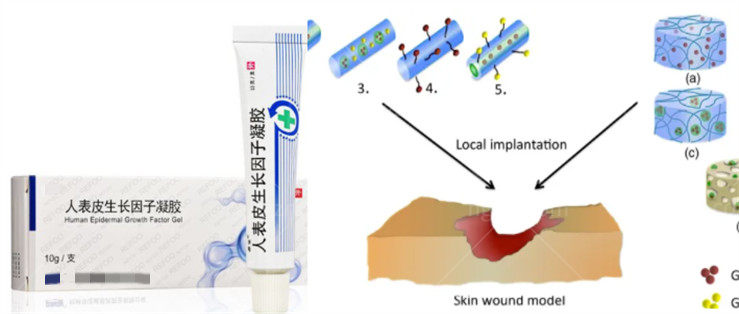 国内哪个医院可以取生长因子