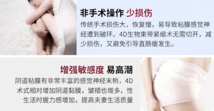 4D生物束带紧缩术