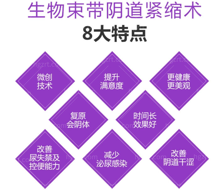 4D生物束带紧缩术