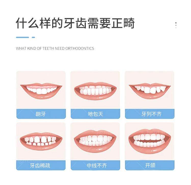 我在上海鼎植口腔医院做的固定牙齿矫正妈妈惊了！