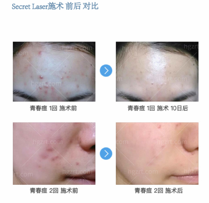 韩国林二石<span style=