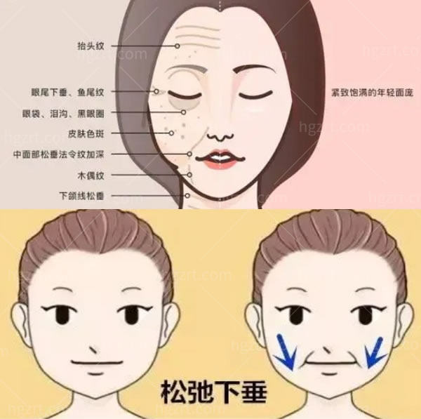 羽毛光雕面部提升.jpg