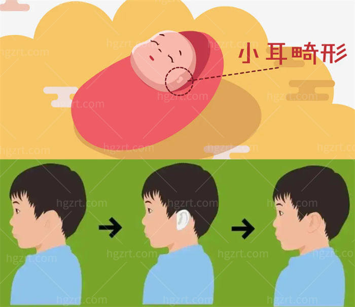 广州耳朵整形手术好的还有高尚医学美容中心