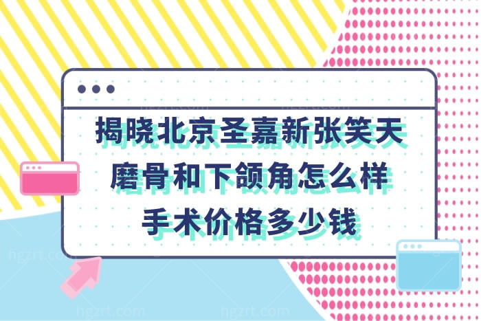 北京圣嘉新磨下颌角怎么样