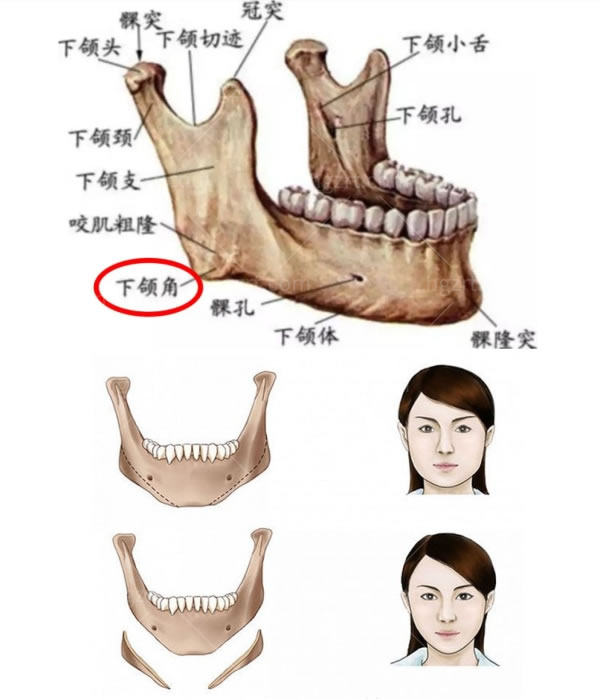 国内下颌角做得好的医生有哪些，下颌角手术属于动骨的高难度手术，要认准医院是否有四级手术资质！来看这些拥有下颌角手术资质的医院。  国内下颌角做得好医院.jpg  国内下颌角做得好医院 国内下颌角做得好医院	国内下颌角做得好的医生有哪些	介绍 北京圣嘉荣医疗美容医院	张笑天	北京圣嘉新医疗美容医院是一家拥有四级资质的正规医疗机构，可以做凸嘴、下颌角、颧骨颧弓、脚骨矫正、长趾缩短、宽足缩窄等高难度手术。张笑天医生从1998年就开始从事颅颌面外科工作，他做的下颌角手术特色是经过大量数据分析在进行黄金比例的测算，就是使鼻尖、下巴、下颌角三个部位的凸点，在在车面能够衔接在一条线上。张笑天医生创新提出的“面部抛物线理论”。 北京圣嘉荣医疗美容医院	张立天	张立天同样在北京圣嘉荣医疗美容医院任职，擅长下颌角磨骨、颧骨内推等轮廓手术，是比较有名的。在做下颌角手术张力天会通过长曲线截骨方式将下颌升支向前移动，相当于重新做出一个下颌角，既能达到缩窄下面部，又能保留顾客对软组织的支撑。 广州广大医院	柳超	广州广大医院创始建于1973年，历史非常悠久，是一家集临床、科研、教学于一体的大型专科医院。柳超以上擅长下颌角整形、颧骨内推、颧骨颧弓、颌面整形、鼻综合隆鼻子等项目。从事整形行业将近十年，是中韩改脸型大师柳大烈的儿子。运用玉雕精细器具柔弧改脸，将下颌曲线精度控制在0.5度以内。 上海华美整形医院	李志海	上海华美整形医院是一家拥有四级颌面手术资质，3级正规机构，并且国内连锁，院内还有麻醉医生团队为求美者保驾护航！ 李志海医生做下颌角手术经验是比较足的，从事整形美容行业三十多年，专注颌面整形就有二十多年，下颌角手术只切除下颌角是不能完全改善，要吧皮质截骨（骨骼的外层）和肌肉，脂肪都一起去除，才可以无死角。 上海薇琳医疗美容医院	穆雄铮	上海薇琳医疗美容医院的口碑在当地是很不错的，是一家中美韩合资连锁品牌ReDream薇琳医美集团（区）旗舰医院。穆雄铮医生以前是大型医院医生，擅长长曲线下颌角、颧骨颧弓整形术、基础下颌角等项目，利用3D数字化技术，打造柔和小V脸，并且在做轮廓手术的时候，采用多维立体调整技术，能够避免术后皮肤松弛下垂的情况。 广州美恩医疗美容整形	周会喜	广东美恩整形医院是广州下颌角做的相对不错的整形医院，是具有四级颌面磨骨手术资质的。广东美恩整形医院早在1995年建立，发展这么多年实力也是相当强大的。，可开展颧骨降低术、下颌角肥大矫正术、 上下颌骨其他成形术、巨乳缩小术、 乳房再造术、腹壁成型术等高难度的整形手术。周会喜医生是国内较为有名的面部轮廓颌面整形手术的医生从业多年不仅下颌角手术技术出色，正颌手术也相当擅长。 武汉亚韩整形外科医院	赵贵庆	亚韩整形医院是一所集医疗、教学、科研于一体的医学美容综合机构，是国内大型连锁机构，在国内兰州、南昌、杭州、天津、成都等城市均有分院。医院面积足有一万多平方米左右，拥有独栋十层大楼的3级整形美容医院。赵贵庆医生擅长颌面部微创整形，从事整形工作二十多年，对于颌面部微创整形有很深的造诣。 成都友谊医院整形美容中心	李继华、罗恩	成都友谊医院整形美容中心是按照3级医院标准建设的大型3级综合医院，拥有四级手术资质，主要以V-line颜面轮廓整形、V-line改脸型等面部轮廓相关技术。院内医生团队强大，能够做下颌角手术的医生也有好几位，李继华、罗恩都比较热门。李继华医生拥有三十多年的从业经验，一直以来专注颌面轮廓、颌面缺损修复重建等相关方面的研究与临床工作手术病例多大上万。罗恩医生同样经验比较丰富，擅长颌面整形、面部轮廓整形、正颌外科、面部畸形整复等。 上海伊莱美医疗美容医院	李湘原	上海伊莱美医疗美容医院的规模是比较大的，医院面积有一万多平方米，地址在上海静安区梅园路88号。李湘原医生是院内擅长下颌角手术的医生之一，经验相当丰富，擅长颧骨降低术、下颌角肥大矫正术、上下颌角其它成形术等。在从医的二十多年一直潜心专研，拥有三万多成功手术病例，在手术中手法细腻自然。 上海时光整形医院	王涛	上海时光整形是一家具有四级手术资质的正规医院，院内配备了经验非常丰富的麻醉医生，都是到做磨骨手术属于高难度手术，要进行全麻哦，有专门的麻醉医生全程跟踪可以手术更加安心。上海时光整形拥有四级手术资质是比较早的，是国内较早获得四级高难度手术资质的医院。王涛医生医生擅长颧骨颧弓降低、颧骨内推、长曲线截骨、下巴截骨和劈外板等面部轮廓手术，技术经验都是十分靠谱的！拥有二十多年的正颌手术和牙颌面畸形矫正的经验，对于人体面部骨骼分布的研究，是非常深刻的。 未命名.jpg  下颌角手术属于高难度手术，在手术之前一定要进行慎重的考虑，到医院进行详细的面诊与医生进行<span style=