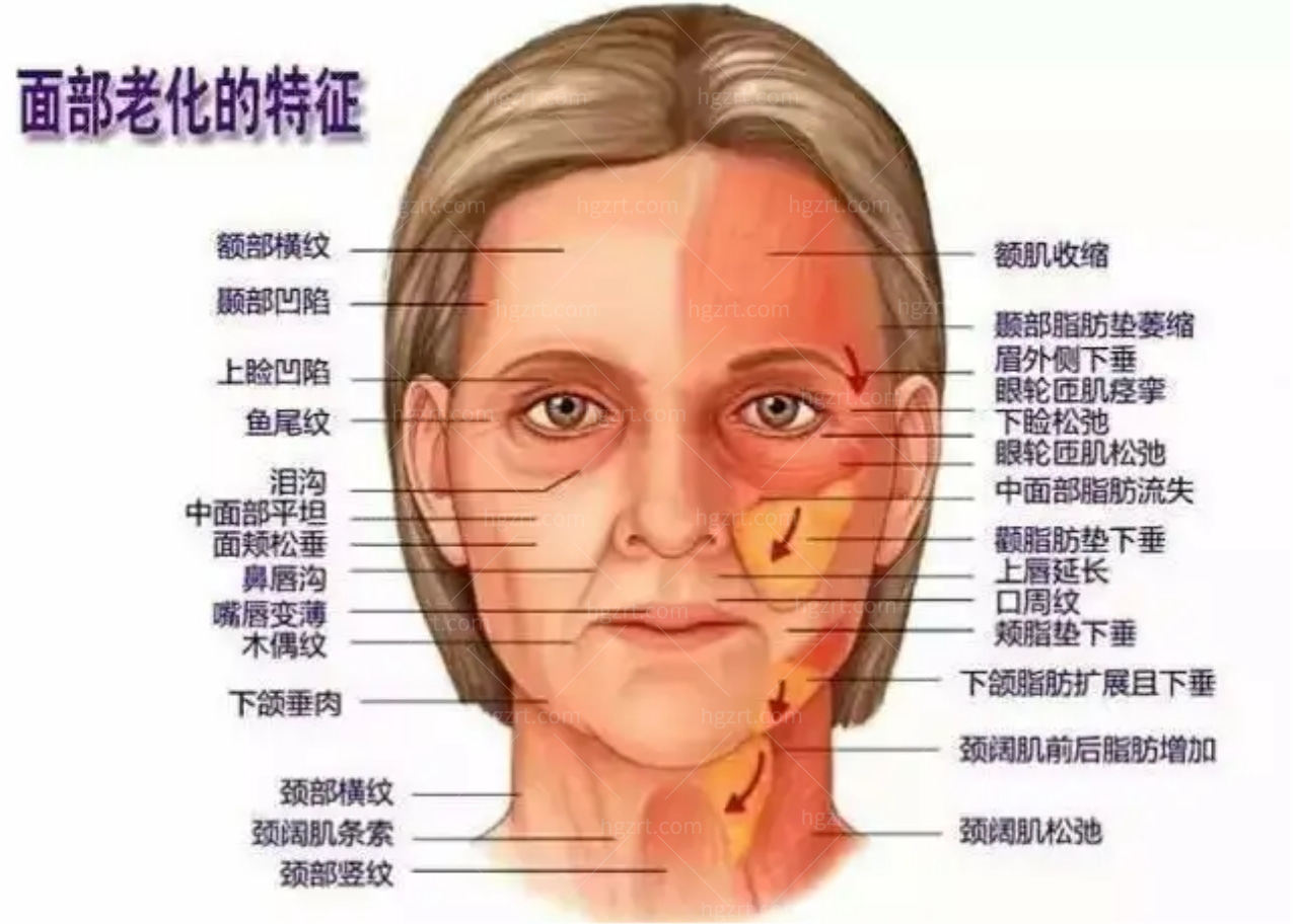 面部老化会出现的特征