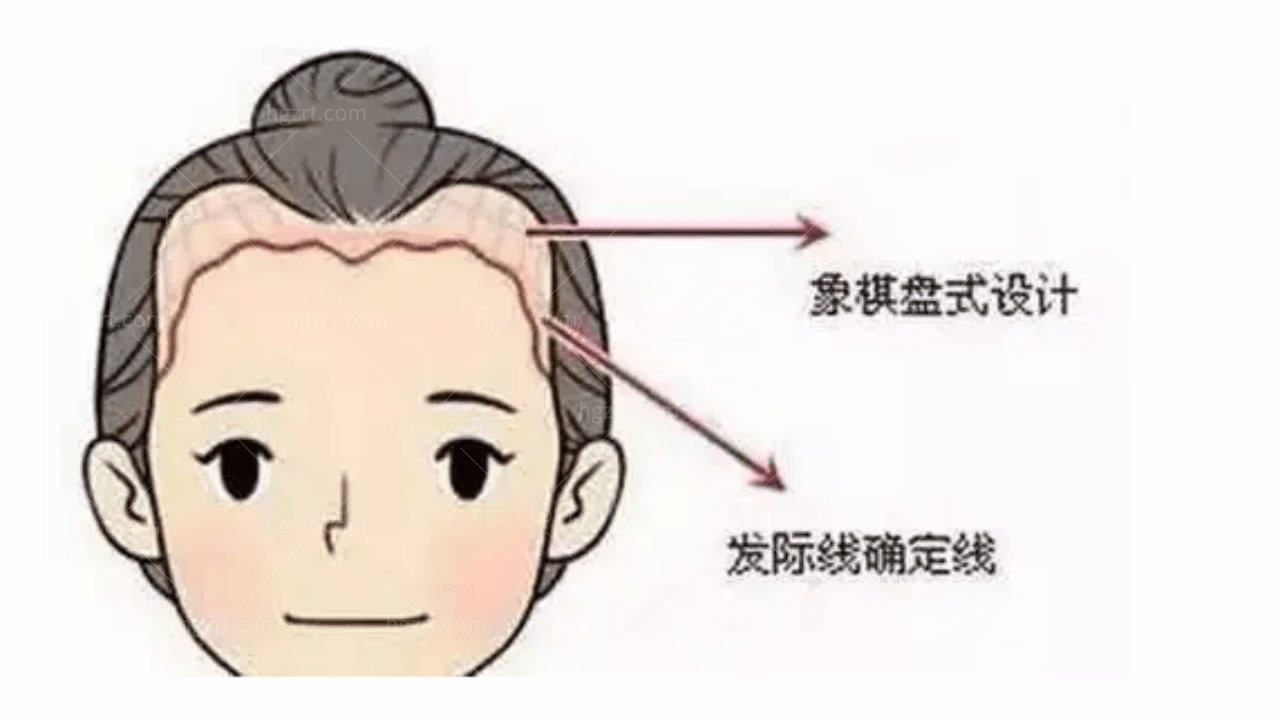 韩国眉毛移植和发际线矫正哪个好？哪家医院做的好？