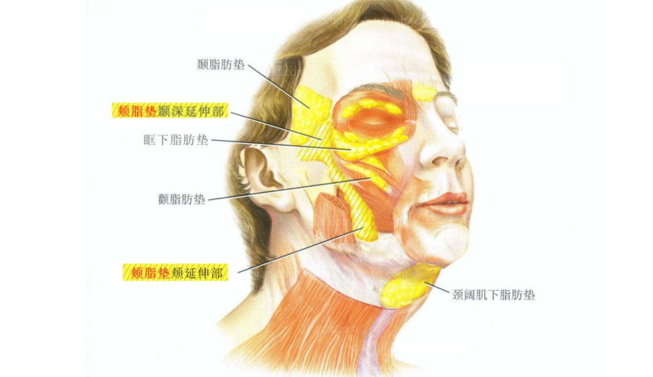 做小拉皮好还是面部支架提升好.jpg