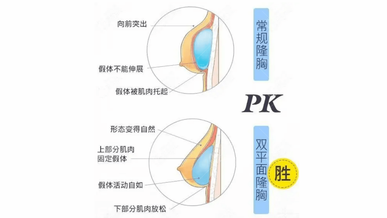 韩国内窥镜隆胸的优点和缺点？你知道哪些？