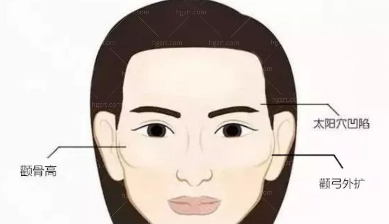 面部轮廓手术的特点.jpg