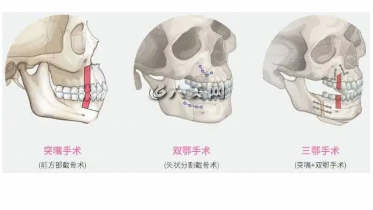 韩国齐娥牙科医院