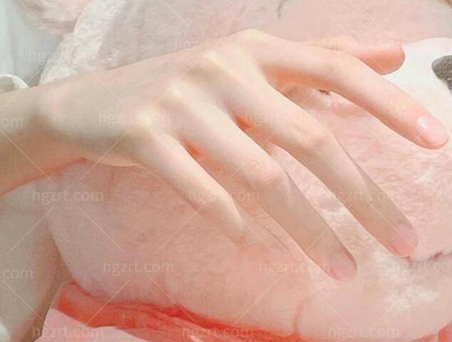 如何让手变得又白又嫩