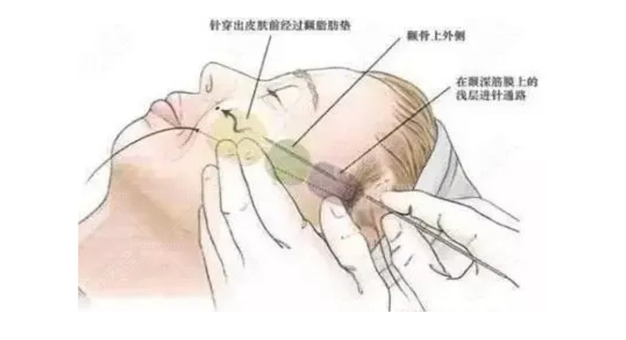 韩国VS整形医院