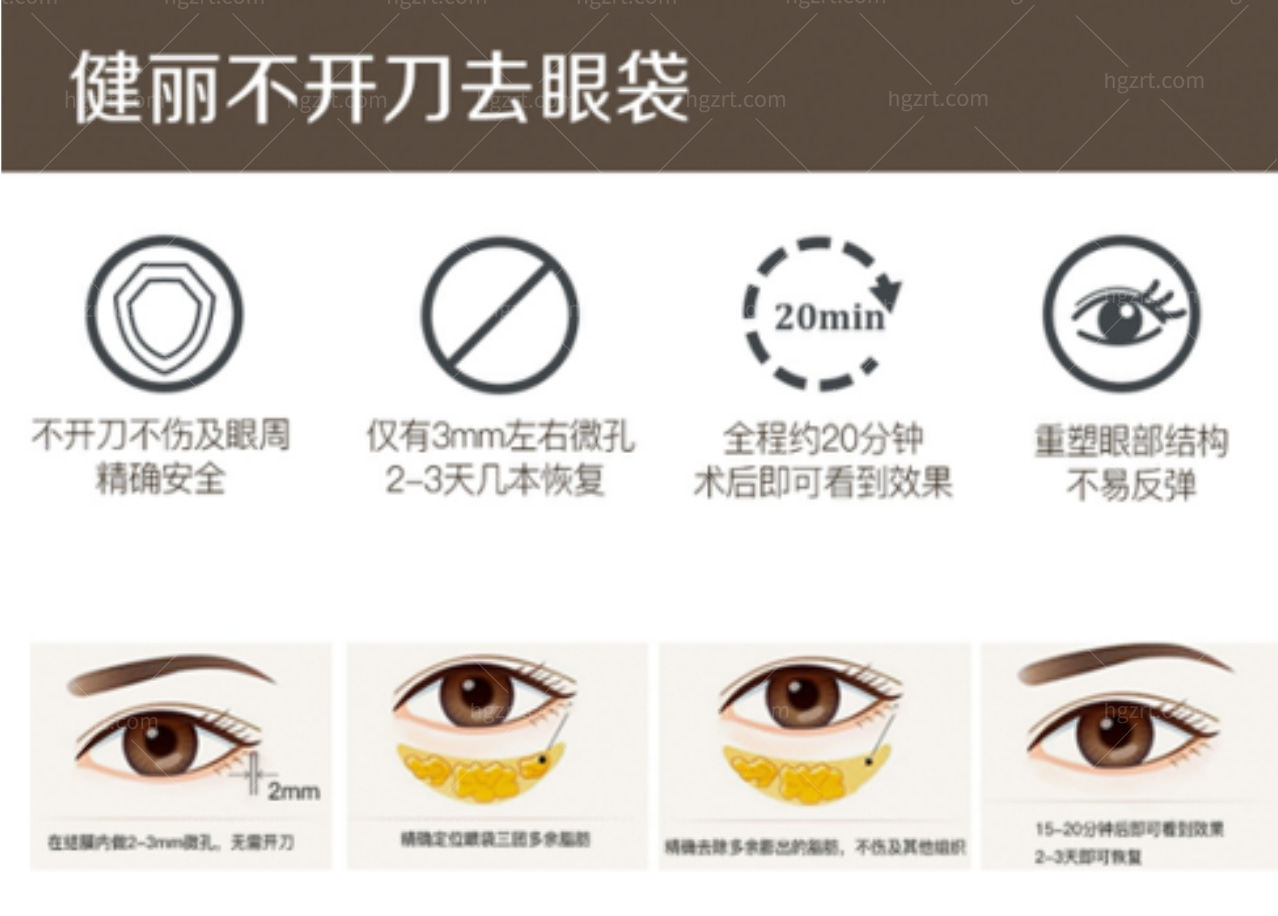 广州健丽眼袋医院不开刀去眼袋手术过程