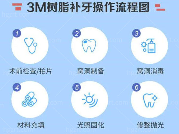 3m树脂补牙价格