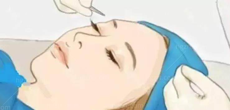 双眼皮修复