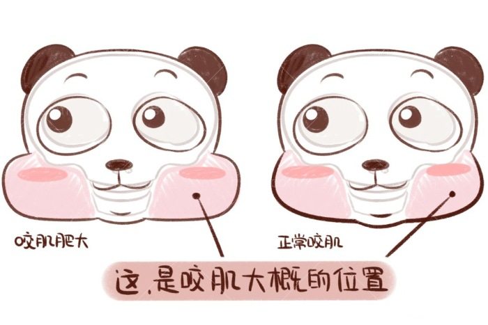 千万别做射频瘦咬肌