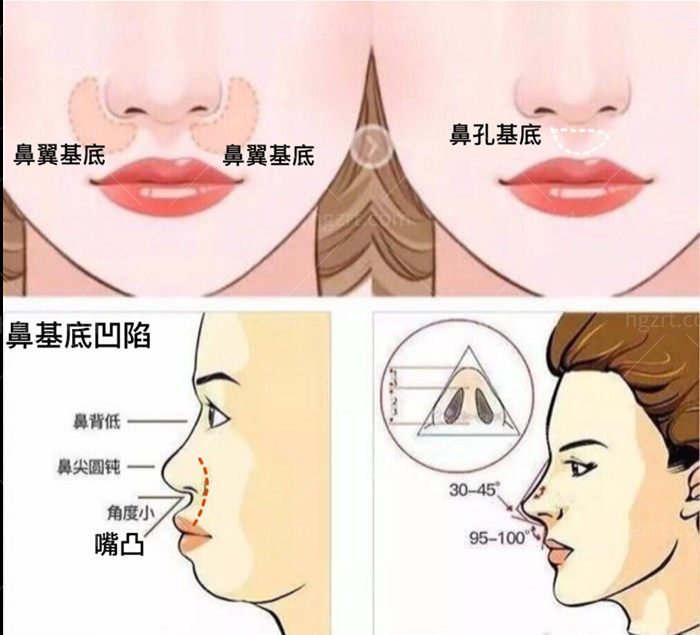 鼻基底的位置