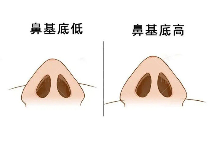 鼻基底