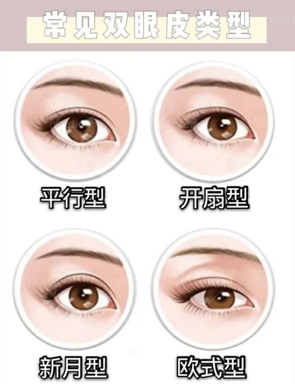 双眼皮类型图片.jpg