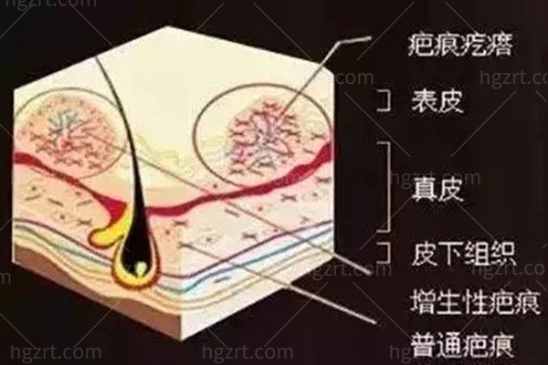 南京哪家整形医院祛疤痕做的好？