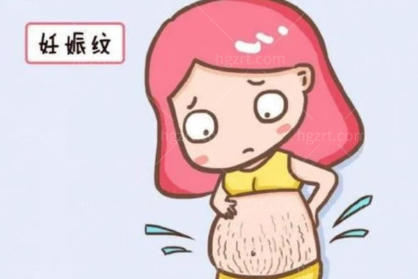 妊娠纹