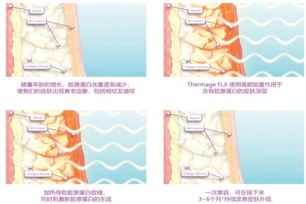 热玛吉作用