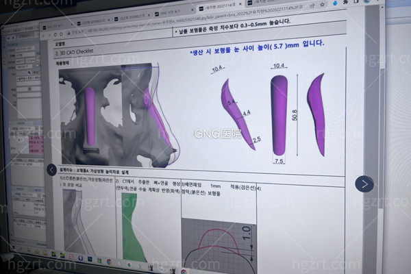 韩国GNG整形医院成龙海院长擅长做高难度鼻修复手术