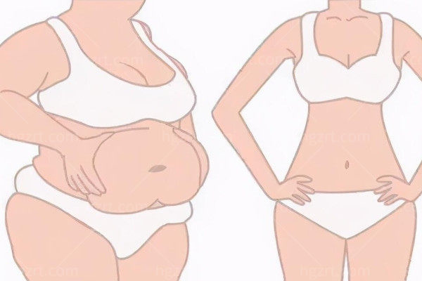 抽脂肪对身体有什么副作用?看看怎么规避这些风险