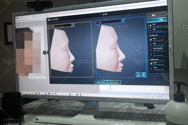 韩国GNG整形外科3D鼻扫描数据