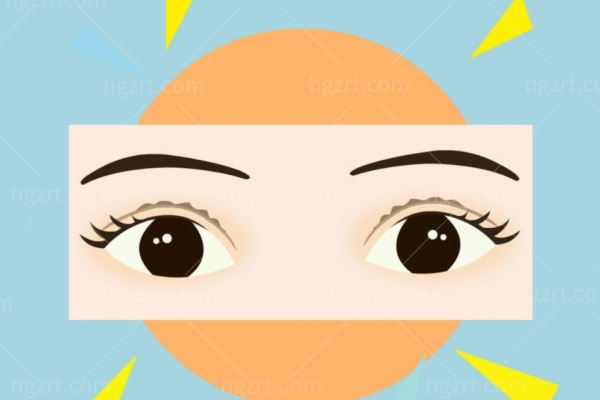 我的全切双眼皮修复经历分享，看似简单的双眼皮手术也要慎重