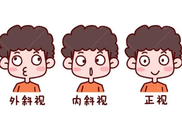 小孩眼睛斜视怎么矫正