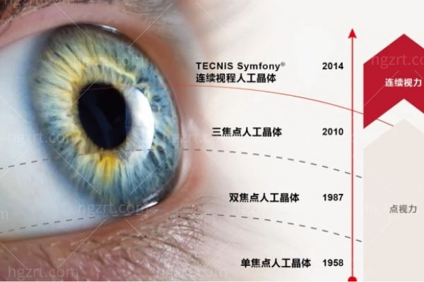 三焦点人工晶体适合人群有哪些