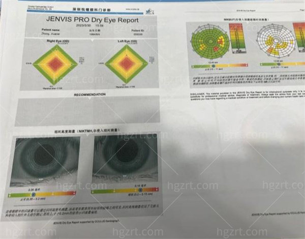 深圳悦瞳眼科检查