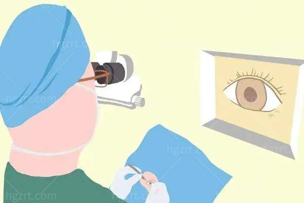 近视眼手术