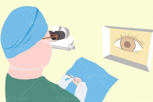 爱尔眼科近视200/600/800/1200/1800度做近视眼手术多少钱