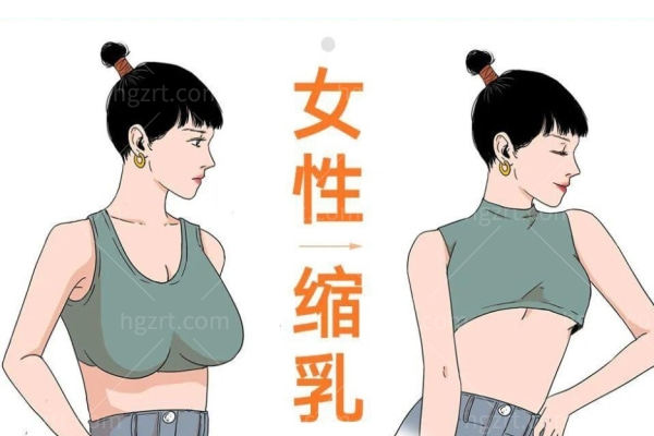 高亚东做巨乳缩小多少钱