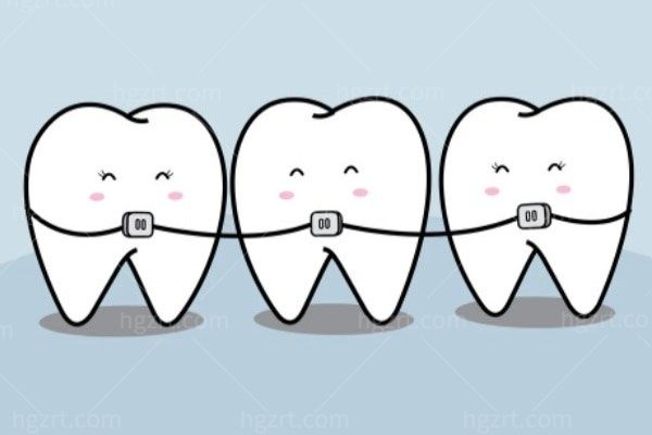 30岁了可以带牙套做牙齿矫正吗?牙套需要戴多长时间呢？
